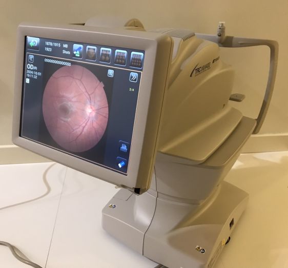 Fundus camera Topcon TRC NW-400