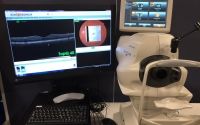 Topcon 3D OCT 1 Maestro system